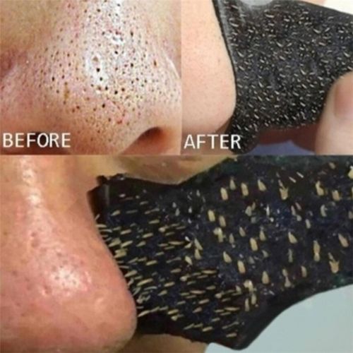 25x Nose Blackhead Remover Strips خمسة وعشرون شريحة لإزالة الرؤوس السوداء من الأنف